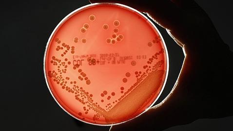 Un móvil tiene 18 veces más bacterias que la cadena del váter