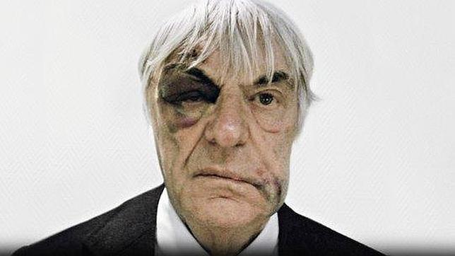 Ecclestone «vende» su ojo morado