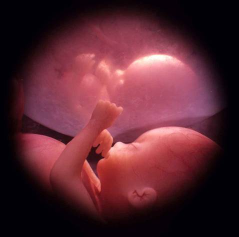 Diagnóstico prenatal sin amniocentesis