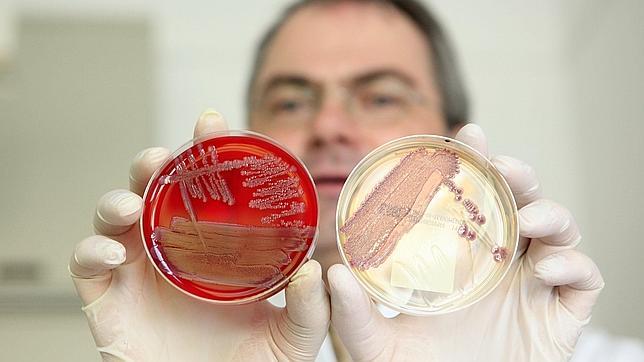 Consejos para evitar el contagio de E.Coli