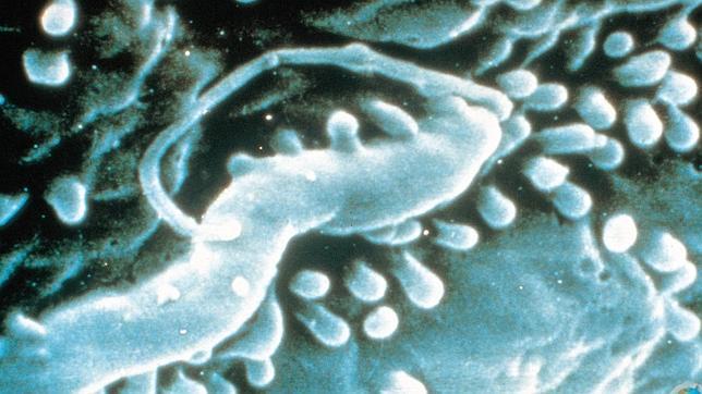 ¿Por qué los hombres tienen más riesgo de sufrir cáncer de estómago?