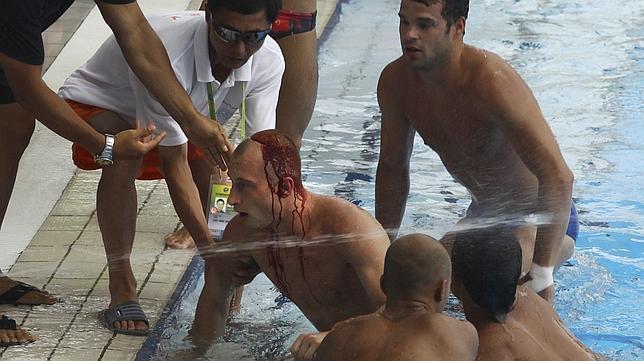 Susto en la prueba de trampolín