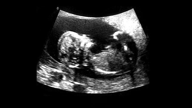 Parir en directo, una obra de arte