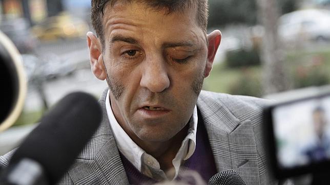 Reconstruyen el nervio facial de Padilla tras 11 horas de operación