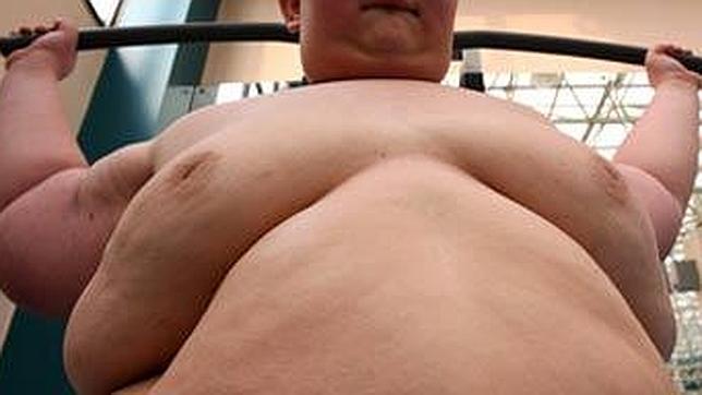 La OCDE calcula en el 7% el crecimiento de la obesidad en España para 2020