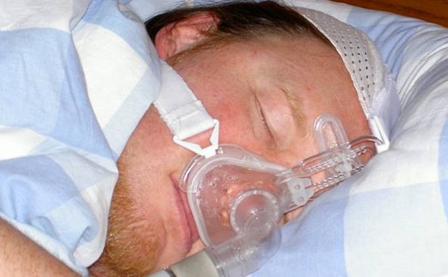 Asocian la apnea del sueño con la HTA y el riesgo cardiovascualar