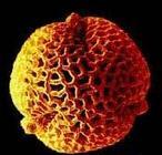 ¿Por qué cada vez hay más alergias?