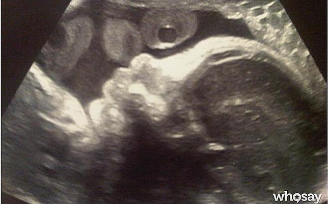 Gerard Piqué enseña la primera imagen de su hijo