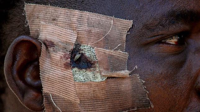 MSF deja Marruecos en medio de la creciente violencia contra inmigrantes
