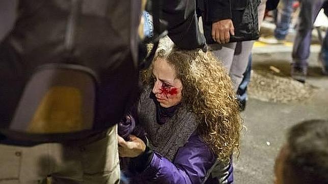 Dos mossos imputados por las lesiones a la mujer que perdió un ojo en la huelga del 14-N