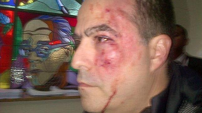 Diputados opositores vuelven a ser agredidos en Parlamento venezolano