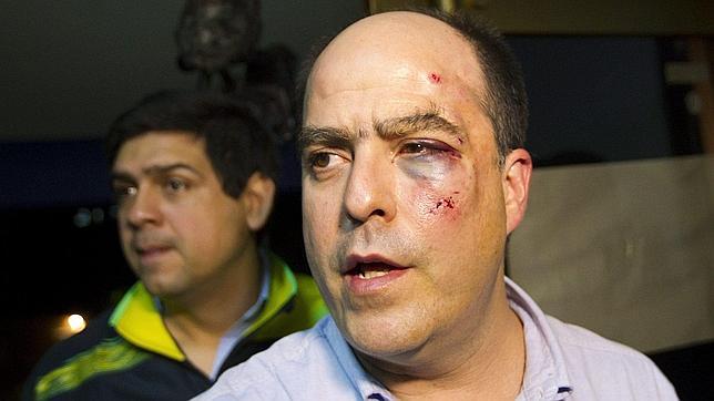 «Los chavistas me rompieron la mandíbula»