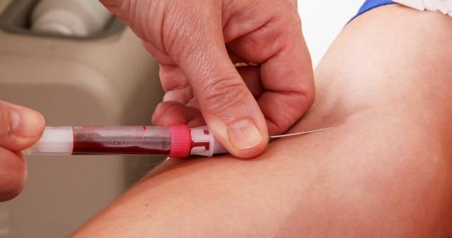 ¿Incentivos a la donación?, no tan mala idea