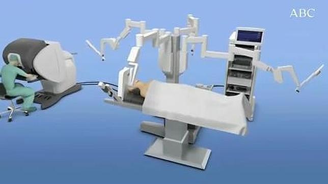 El robot Da Vinci para combatir la apnea del sueño