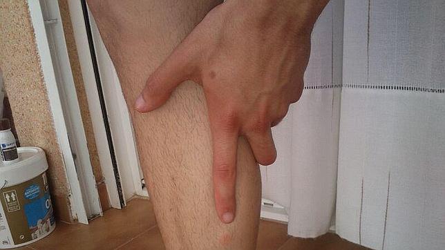 Diez consejos para evitar las picaduras de mosquito