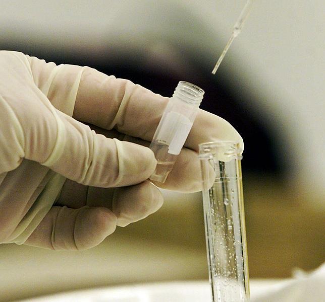 Sanidad eleva a sesenta el número de enfermedades de declaración obligatoria