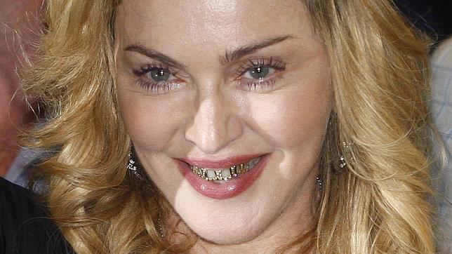 Madonna baña de oro y diamantes su sonrisa