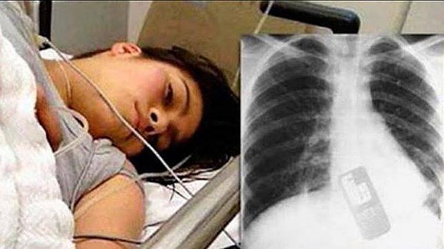 Una joven se traga el teléfono móvil para evitar que su novio le lea los mensajes