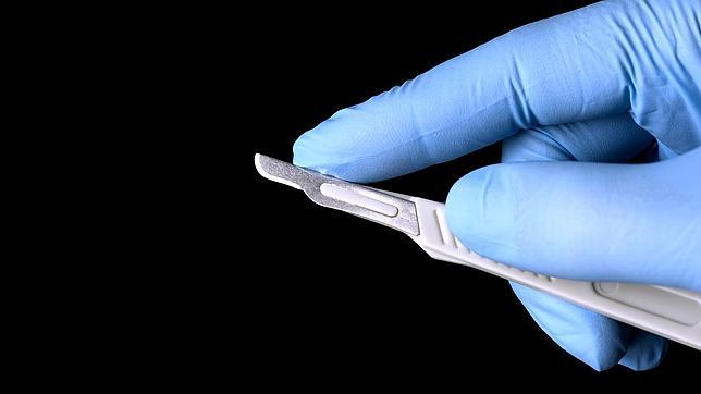 Los investigadores proponen un tratamiento quirúgico ante una «epidemia» de amputación de penes