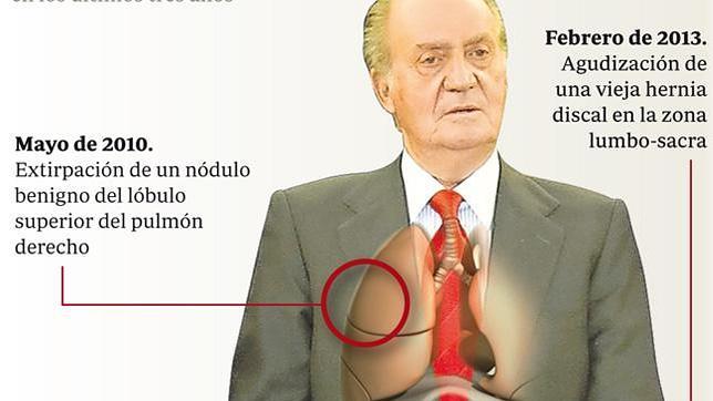 El Rey, sometido a siete operaciones desde 2010