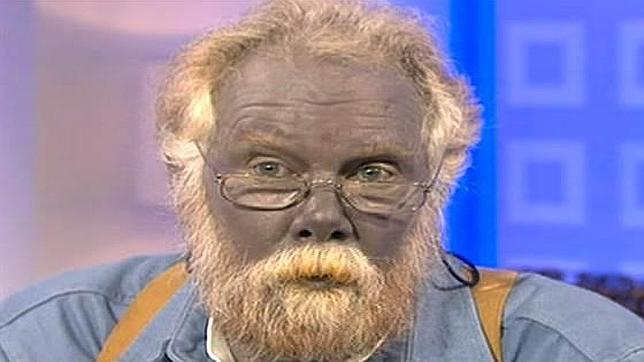 El hombre azul muere de un infarto