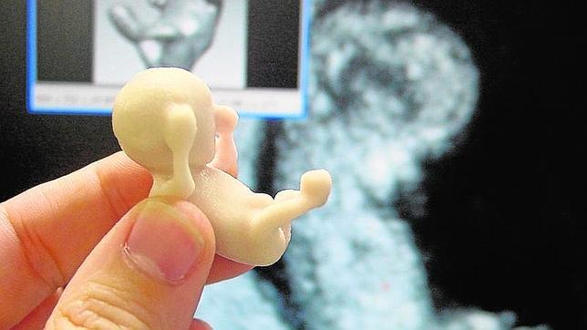 Los provida creen que una ecografía «muestra la realidad a la mujer» antes de abortar