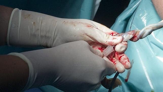 España, líder mundial en bancos y uso terapéutico de sangre de cordón umbilical