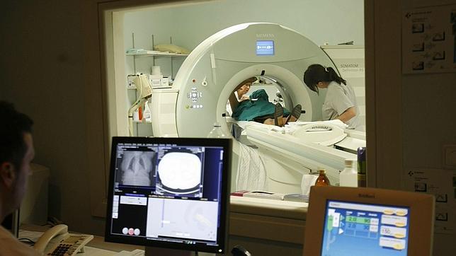 Detectar cuanto antes un ictus es clave para evitar secuelas