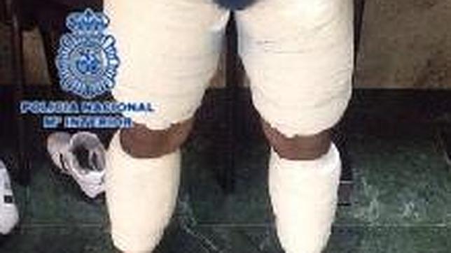 Lo último: mulas de la droga con cocaína «escayolada» en las piernas