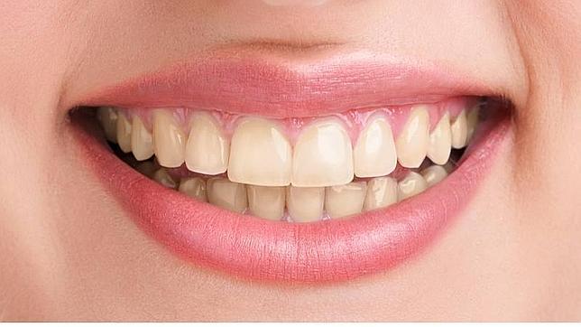Los dentistas advierten del peligro de los blanqueamientos dentales inadecuados