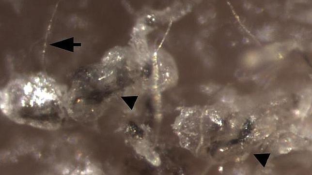 Células madre contra la calvicie ¿la solución definitiva?
