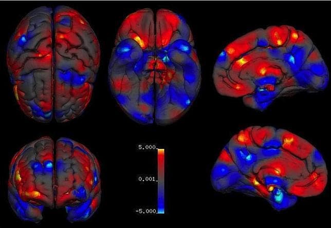 En efecto, los hombres tienen el cerebro más grande que las mujeres