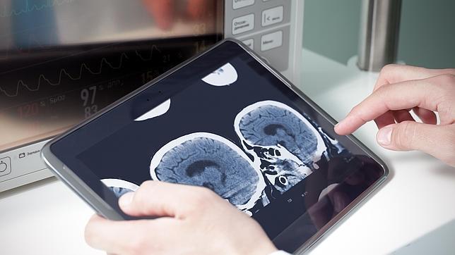 El síndrome de Dravet es una patología rara y grave que aparece en la infancia y produce crisis epilépticas