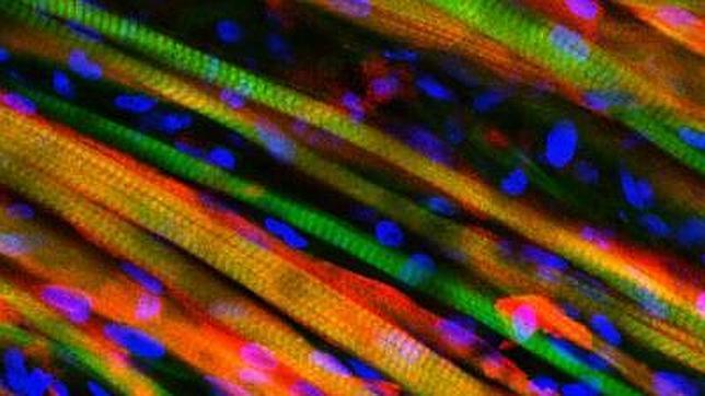 Crean en laboratorio un músculo vivo que se repara a sí mismo
