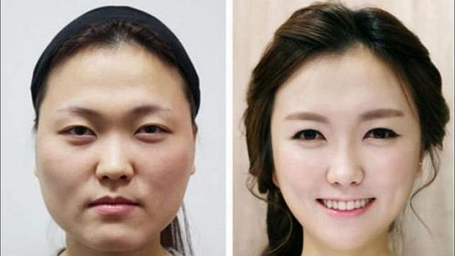 El éxito de la cirugía en Corea del Sur obliga a los pacientes a pedir certificados para demostrar su identidad