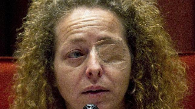 El juez concluye que Ester Quintana perdió el ojo por una pelota de goma