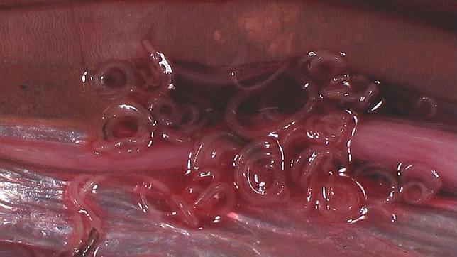¿Qué es el anisakis y cómo evitarlo?