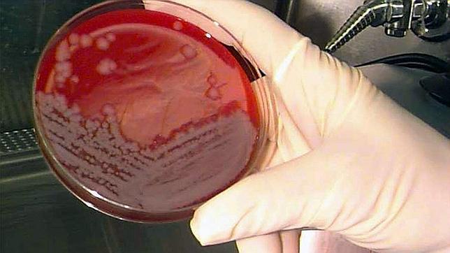 Decenas de científicos pueden haber estado expuestos al ántrax en un laboratorio de Atlanta