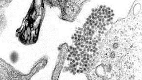 ¿El virus del dengue puede llegar a Europa gracias al Mundial de Brasil?