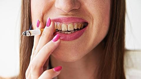 ¿Cómo afecta el tabaco a la encía?