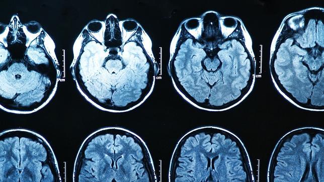 ¿Ver porno encoge el cerebro?