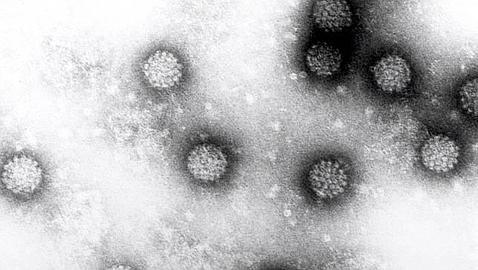 Un test ayuda a predecir la recurrencia en cáncer oral asociado al virus del papiloma