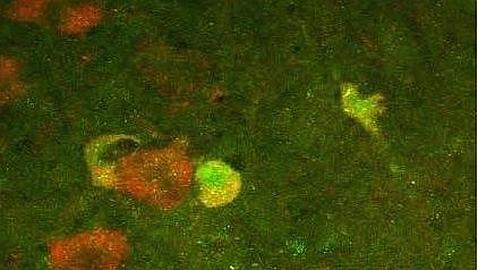 P45, la proteína que impide la regeneración nerviosa en humanos