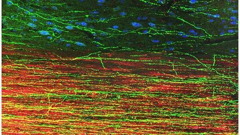 Neuronas fabricadas a partir de células iPS logran regenerarse tras su injerto en ratas