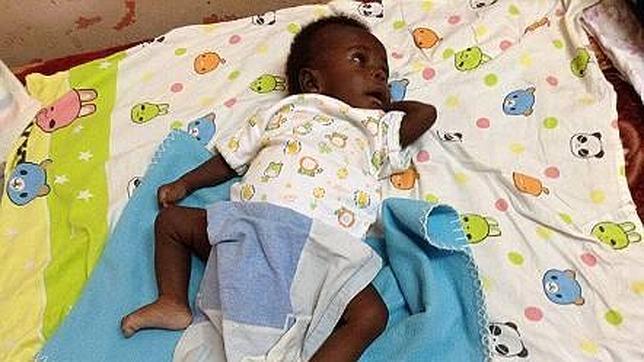 Operan Con éxito A Un Bebé Que Nació En Uganda Con Cuatro Piernas Y Cuatro Brazos 0081
