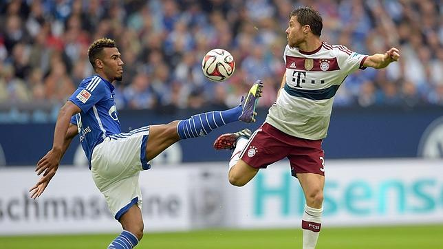 Xabi Alonso sufre una extraña lesión que solo le permite andar hacia adelante