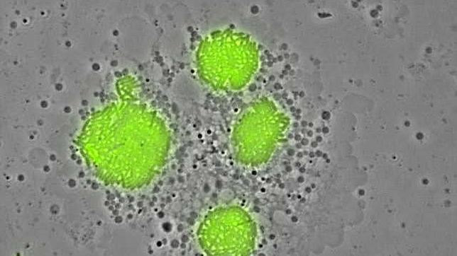 Dos personas fallecen y otras 20 afectadas por legionelosis en Sabadell