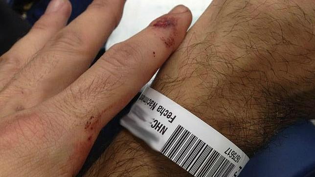 Paliza a dos jóvenes al grito de «maricones» en pleno centro de Madrid