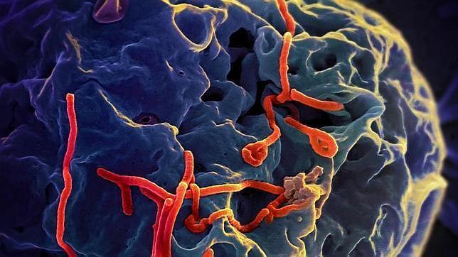 ¿Por qué está agotado el ZMapp, la posible cura para el virus ébola?