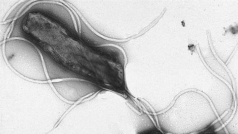 Guerra a la bacteria H. pylori para prevenir el cáncer de estómago